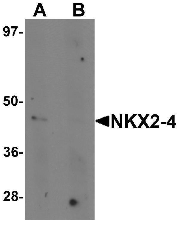 a16202 1 nkx2 4 primary antibodies wb testing 1