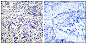 a16218 plcxd1 primary antibodies ihc testing 1