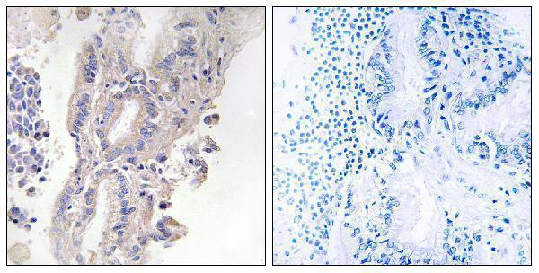 a16218 plcxd1 primary antibodies ihc testing 2