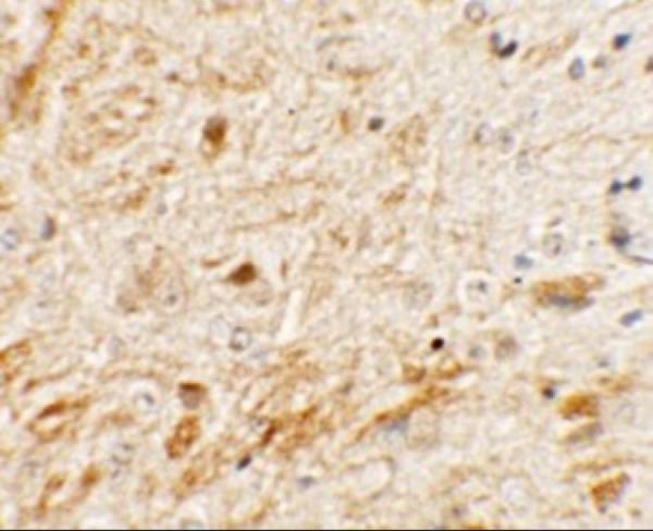 Immunohistochemistry of TMEM106A in mouse brain tissue with TMEM106A antibody at 5 μg/mL