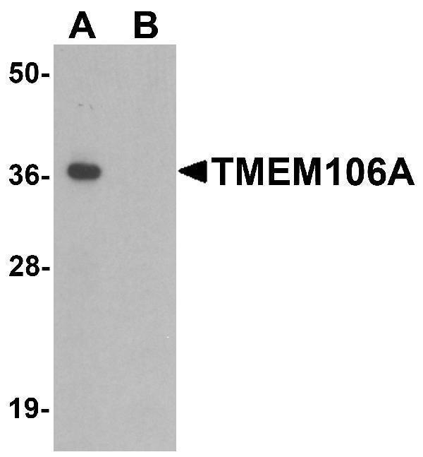 Western blot analysis of TMEM106A in A-20 cell lysate with TMEM106A antibody at 1 μg/mL in (A) the absence and (B) the presence of blocking peptide