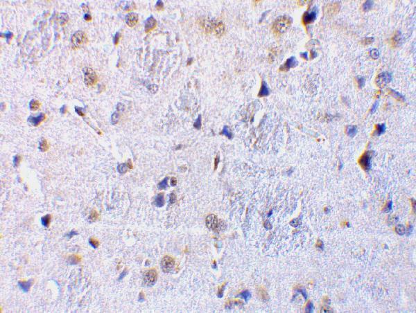 a16229 1 c1qtnf7 primary antibodies ihc testing 2