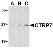 a16229 1 c1qtnf7 primary antibodies wb testing 1