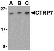 a16229 c1qtnf7 primary antibodies wb testing 1