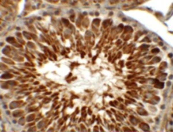 a16234 tekt5 primary antibodies ihc testing 2