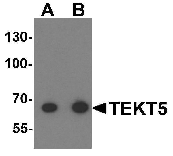 a16234 tekt5 primary antibodies wb testing 1