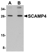 a16237 scamp4 primary antibodies wb testing 1