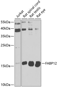 Western blot analysis of extracts of various cell lines, using FABP12 antibody  at 1:1000 dilution