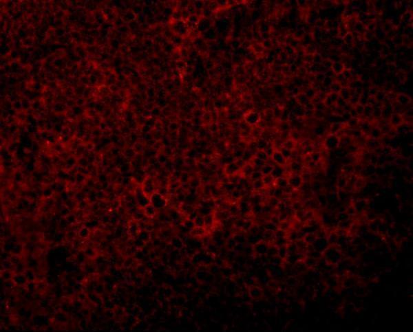a16245 jmjd4 primary antibodies if testing 3