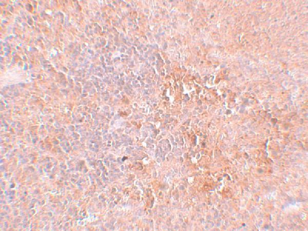 a16245 jmjd4 primary antibodies ihc testing 2