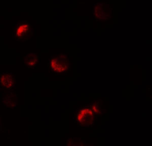 a16256 ypel1 primary antibodies if testing 3