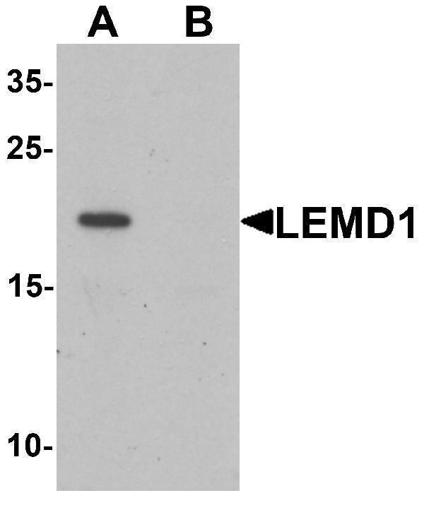 Western blot analysis of LEMD1 in A20 cell lysate with LEMD1 antibody at 1 μg/mL in (A) the absence and (B) the presence of blocking peptide
