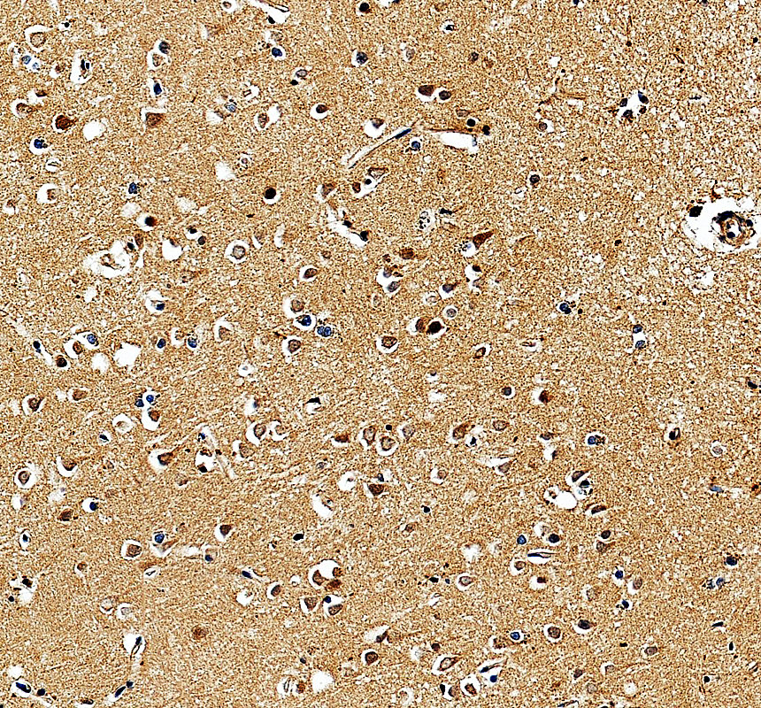 IHC analysis of KLHL11 using anti-KLHL11 antibody (A16260-1)