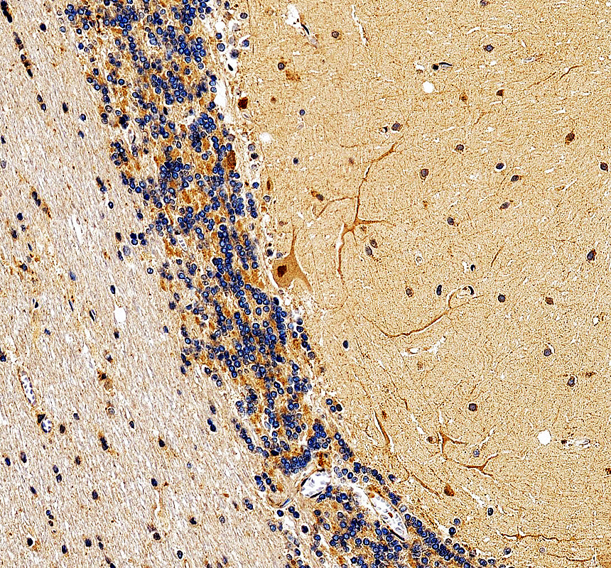 IHC analysis of KLHL11 using anti-KLHL11 antibody (A16260-1)