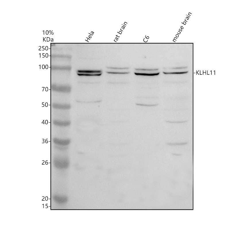 Western blot analysis of KLHL11 using anti-KLHL11 antibody (A16260-1)