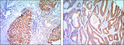 a16260 klhl11 primary antibodies ihc testing 3
