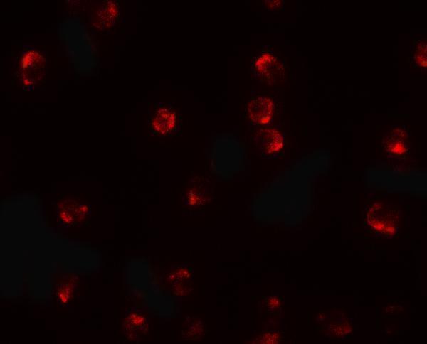 a16263 tctex1d2 primary antibodies if testing 2