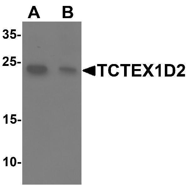 a16263 tctex1d2 primary antibodies wb testing 1