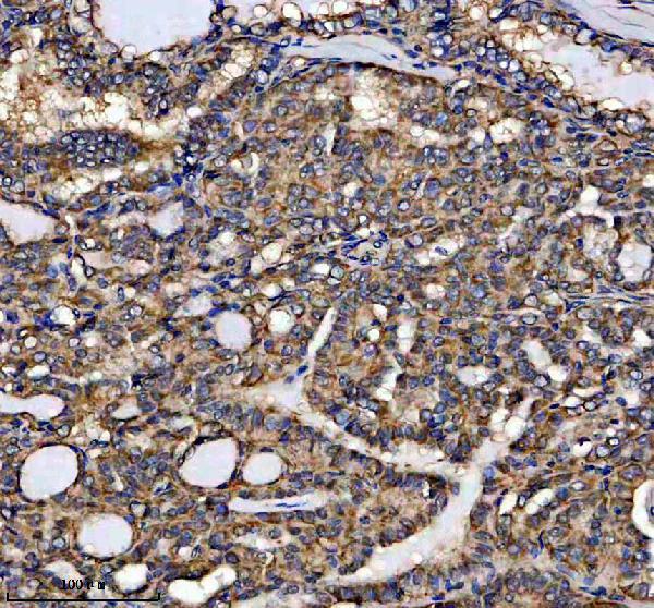 a16288 gtpbp6 primary antibodies ihc testing 1