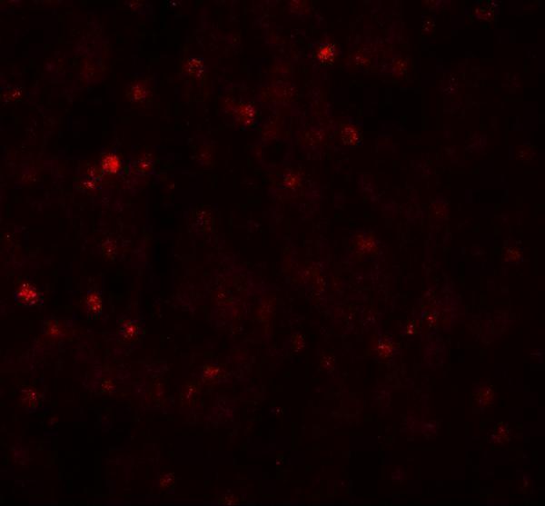 a16294 tctex1d4 primary antibodies if testing 2