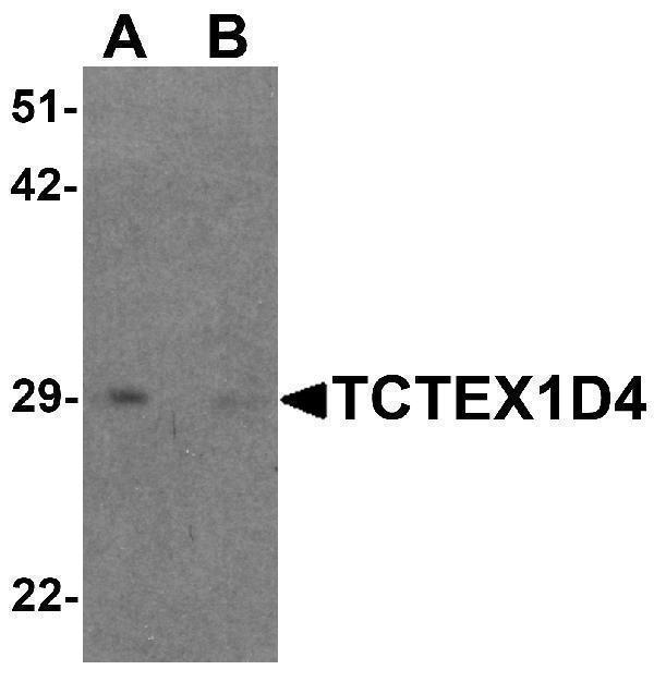a16294 tctex1d4 primary antibodies wb testing 1