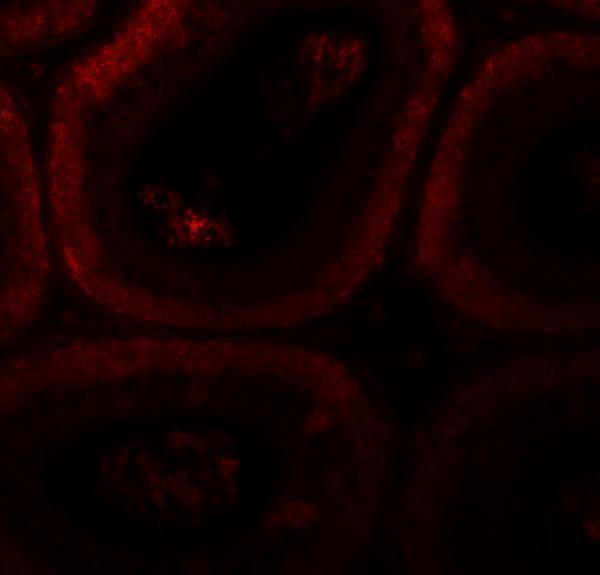 a16295 spata3 primary antibodies if testing 3