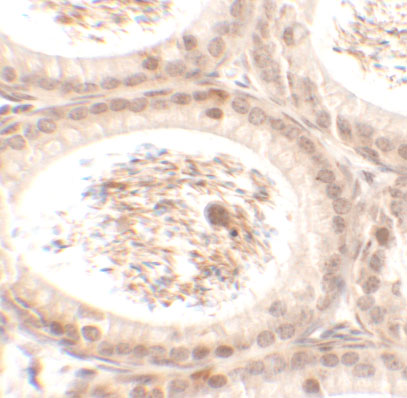 a16295 spata3 primary antibodies ihc testing 2