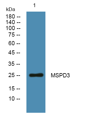 Western blot analysis of lysates from U2OS cells, primary antibody was diluted at 1:1000, 4°over night
