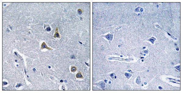 Immunohistochemistry analysis of paraffin-embedded human brain tissue, using ARRDC2 Antibody