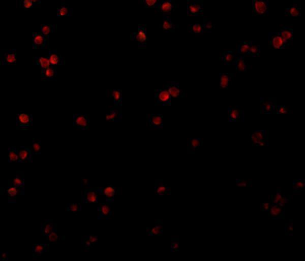 a16305 1 c1qtnf2 primary antibodies if testing 3