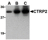 a16305 1 c1qtnf2 primary antibodies wb testing 1