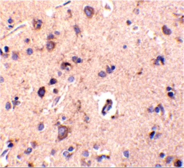 a16305 c1qtnf2 primary antibodies ihc testing 2