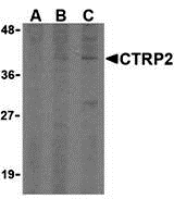 a16305 c1qtnf2 primary antibodies wb testing 1