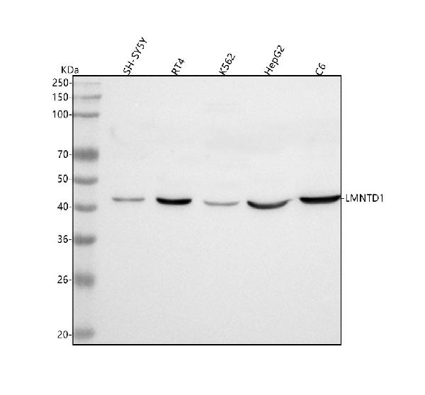 Figure 1. Western blot analysis of IFTLD1/LMNTD1 using anti-IFTLD1/LMNTD1 antibody (A16307-1). Electrophoresis was performed on a 5-20% SDS-PAGE gel at 70V (Stacking gel) / 90V (Resolving gel) for 2-3 hours. The sample well of each lane was loaded with 30 ug of sample under reducing conditions. Lane 1: human SH-SY5Y whole cell lysates, Lane 2: human RT4 whole cell lysates, Lane 3: human K562 whole cell lysates, Lane 4: human HepG2 whole cell lysates, Lane 5: rat C6 whole cell lysates. After electrophoresis, proteins were transferred to a nitrocellulose membrane at 150 mA for 50-90 minutes. Blocked the membrane with 5% non-fat milk/TBS for 1.5 hour at RT. The membrane was incubated with rabbit anti-IFTLD1/LMNTD1 antigen affinity purified polyclonal antibody (Catalog # A16307-1) at 0.5 microg/mL overnight at 4°C, then washed with TBS-0.1%Tween 3 times with 5 minutes each and probed with a goat anti-rabbit IgG-HRP secondary antibody at a dilution of 1:5000 for 1.5 hour at RT. The signal is developed using an Enhanced Chemiluminescent detection (ECL) kit (Catalog # EK1002) with Tanon 5200 system. A specific band was detected for IFTLD1/LMNTD1 at approximately 43 kDa. The expected band size for IFTLD1/LMNTD1 is at 43 kDa.