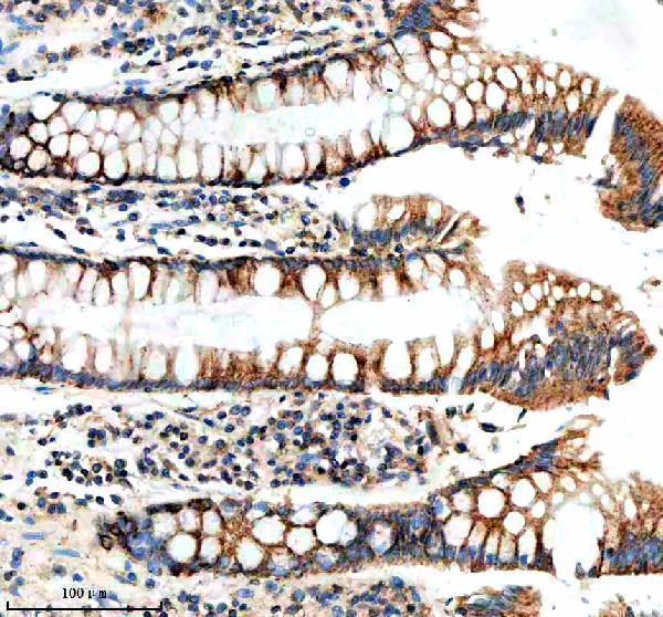 a16309 1 nudt8 primary antibodies ihc testing 2