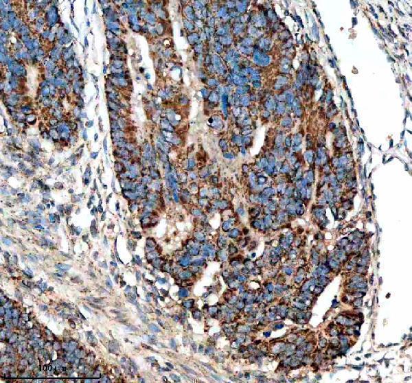 a16309 1 nudt8 primary antibodies ihc testing 3