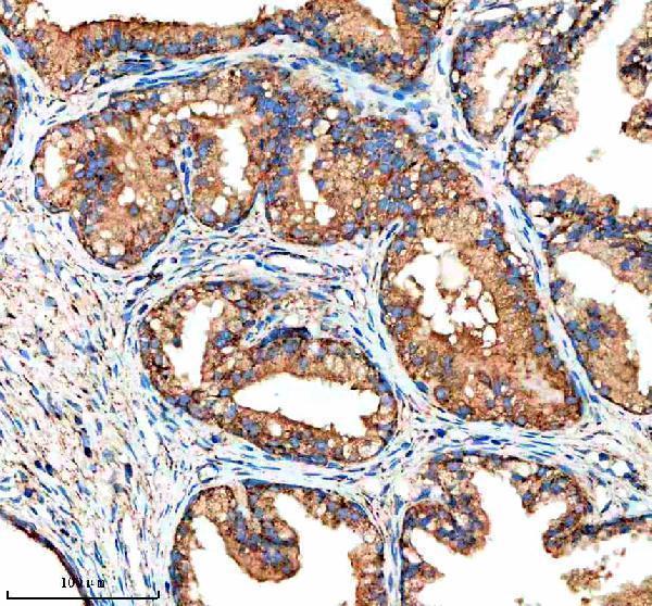 a16309 1 nudt8 primary antibodies ihc testing 4