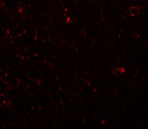 Immunofluorescence of PLKHM3 in human brain tissue with PLKHM3 antibody at 20 μg/mL
