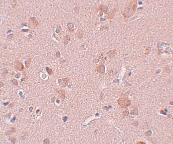 Immunohistochemistry of PLEKHM3 in human brain tissue with PLEKHM3 antibody at 5 μg/mL