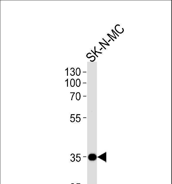 NKX1-1 Antibody (Center) (Cat