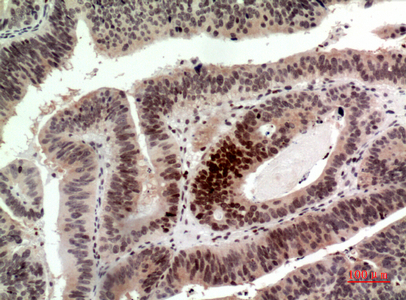 a16318 hist1h2ag primary antibodies ihc testing 1