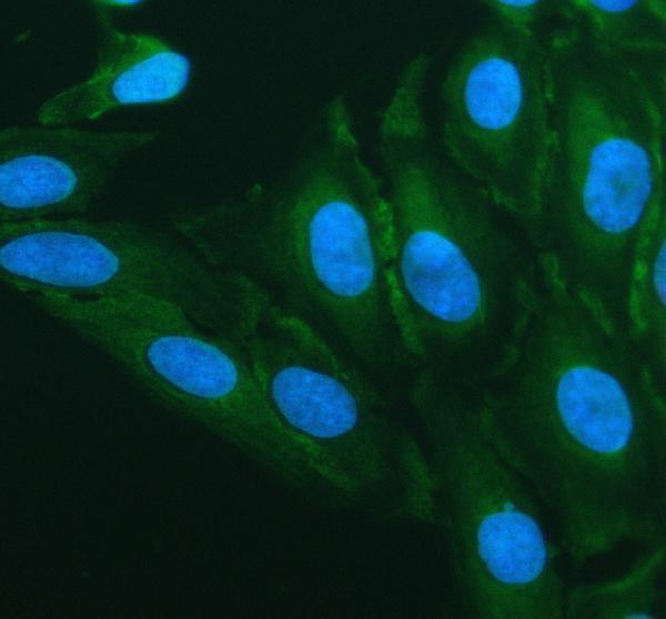 a16326 1 lrrc40 primary antibodies if testing 1