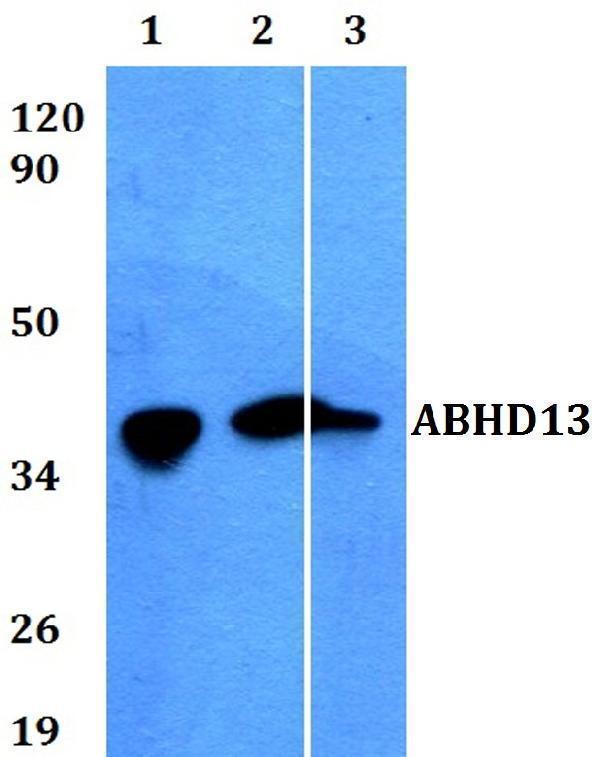 Western blot (WB) analysis of ABHD13 polyclonal antibody at 1:500 dilution
Lane1:HEK293T whole cell lysate
Lane2:Raw264