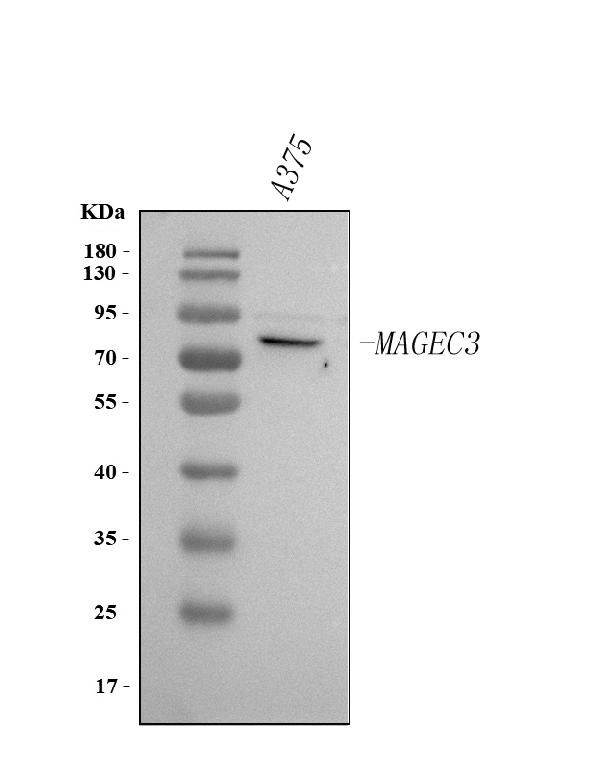 Figure 1. Western blot analysis of MAGEC3 using anti-MAGEC3 antibody (A16360-1). Electrophoresis was performed on a 5-20% SDS-PAGE gel at 70V (Stacking gel) / 90V (Resolving gel) for 2-3 hours. The sample well of each lane was loaded with 30 ug of sample under reducing conditions. Lane 1: human A375 whole cell lysates. After electrophoresis, proteins were transferred to a nitrocellulose membrane at 150 mA for 50-90 minutes. Blocked the membrane with 5% non-fat milk/TBS for 1.5 hour at RT. The membrane was incubated with rabbit anti-MAGEC3 antigen affinity purified polyclonal antibody (Catalog # A16360-1) at 0.5 microg/mL overnight at 4°C, then washed with TBS-0.1%Tween 3 times with 5 minutes each and probed with a goat anti-rabbit IgG-HRP secondary antibody at a dilution of 1:5000 for 1.5 hour at RT. The signal is developed using an Enhanced Chemiluminescent detection (ECL) kit (Catalog # EK1002) with Tanon 5200 system. A specific band was detected for MAGEC3 at approximately 72 kDa. The expected band size for MAGEC3 is at 72 kDa.