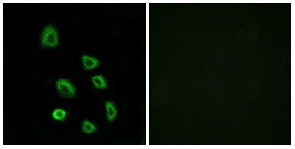 a16375 or5k1 primary antibodies if testing 1