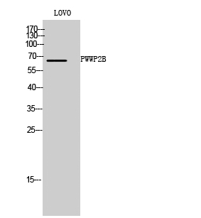 a16385 1 pwwp2b primary antibodyes wb testing 1