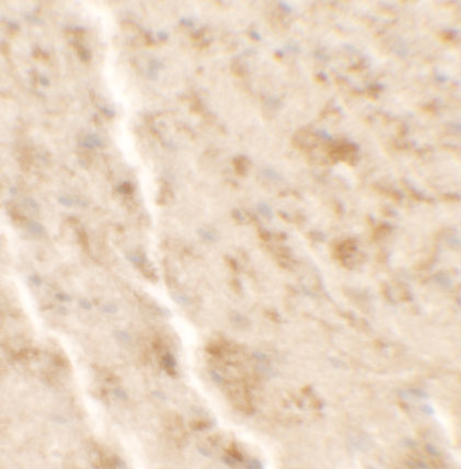 Immunohistochemistry of SHISA4 in mouse brain tissue with SHISA4 antibody at 2