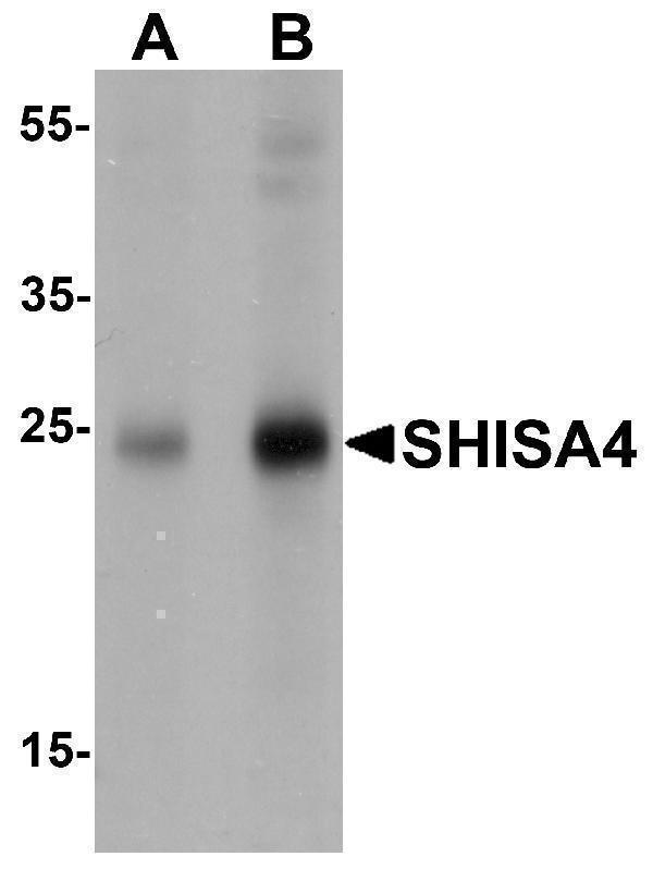 Western blot analysis of SHISA4 in human brain tissue lysate with SHISA4 antibody at (A) 1 and (B) 2 μg/mL