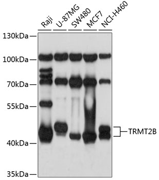 Western blot analysis of extracts of various cell lines, using TRMT2B antibody  at 1:1000 dilution