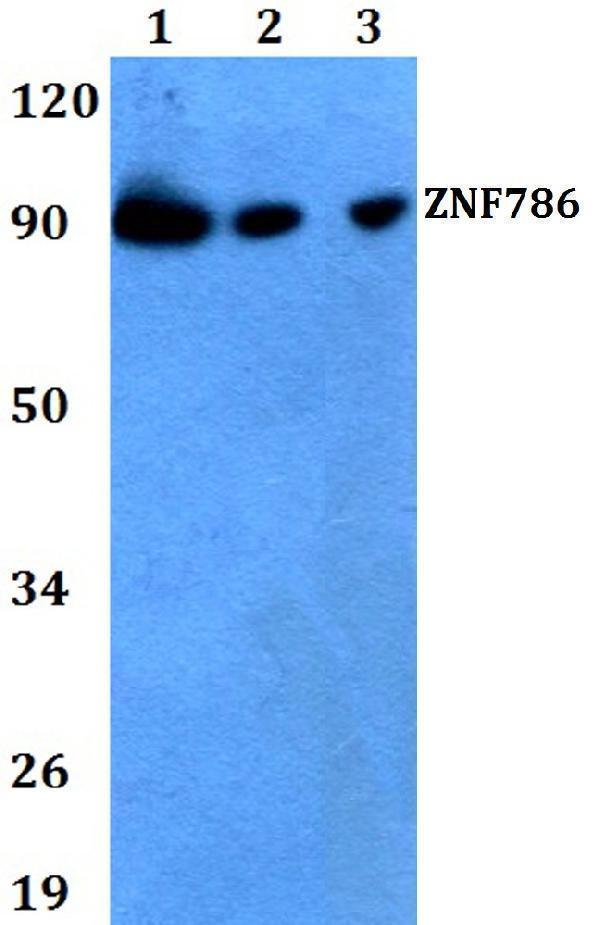 Western blot (WB) analysis of ZNF786 polyclonal antibody at 1:500 dilution
Lane1:HEK293T whole cell lysate
Lane2:Raw264
